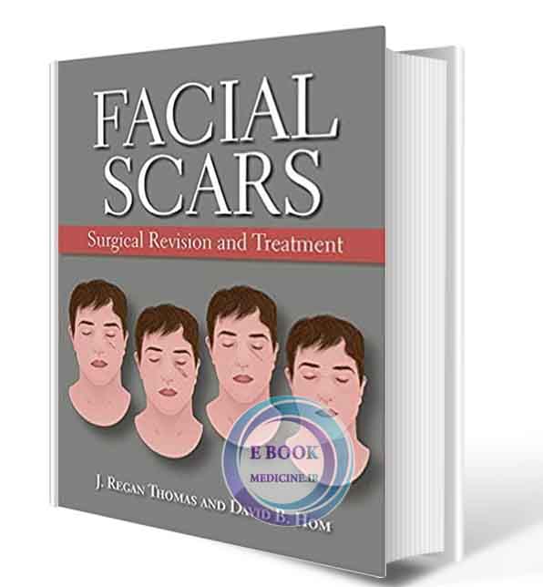 دانلود کتاب Facial Scars: Surgical Revision and Treatment  2019  ( PDF)